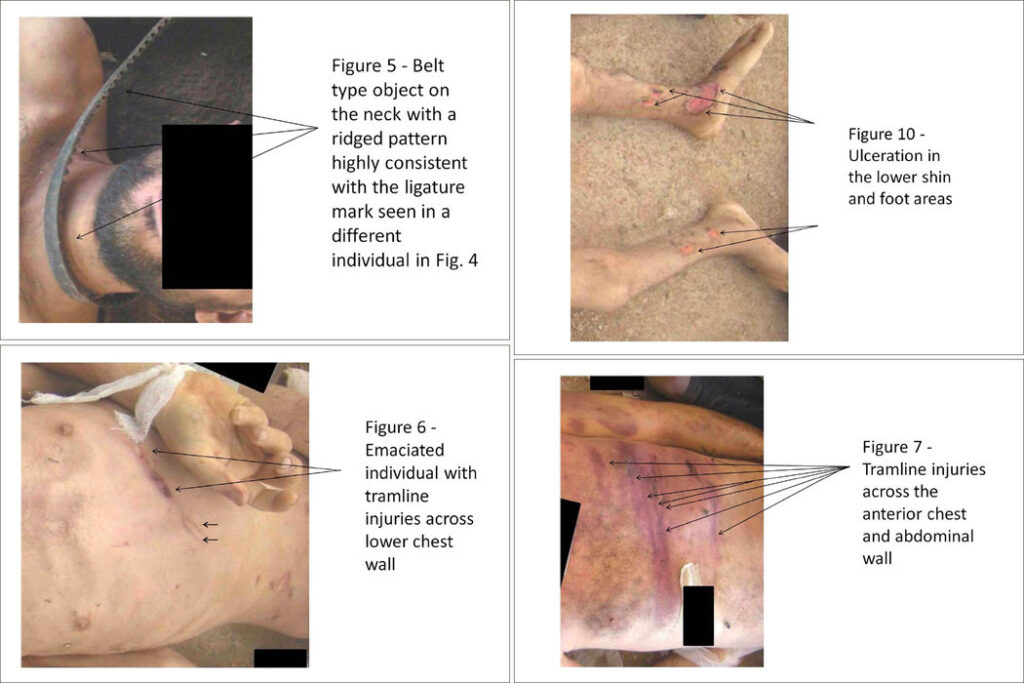 Photo Archive Is Said To Show Widespread Torture In Syria The New 